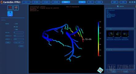 生物流體力學賦能精準醫療，晟視科技近億元Pre-A輪融資引領超聲技術創新